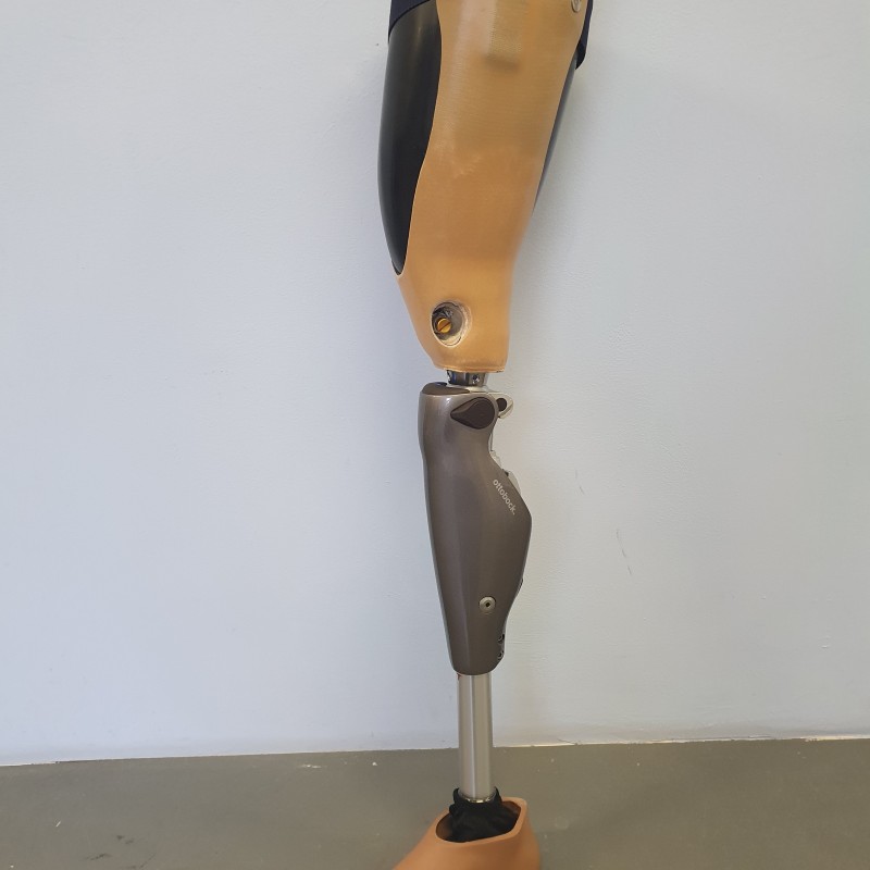Oberschenkelprothese mit Haftschaftsystem elektronischem Kniegelenk C Leg und absatzverstellbarem Carbonfuss