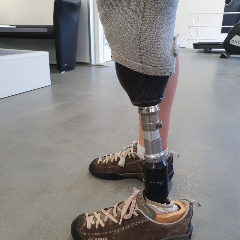 Vakuum Unterschenkelprothese Seitansicht im lockeren Stand
